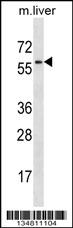Mouse Map2k7 Antibody (Center) (Cat# 102-12339) western blot analysis in mouse liver tissue lysates (35ug/lane).This demonstrates the Map2k7 antibody detected the Map2k7 protein (arrow).
