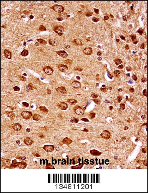 Mouse Map2k7 Antibody (Center) (102-12339)immunohistochemistry analysis in formalin fixed and paraffin embedded mouse brain tissue followed by peroxidase conjugation of the secondary antibody and DAB staining.This data demonstrates the use of Mouse Map2k7 Antibody (Center) for immunohistochemistry. Clinical relevance has not been evaluated.