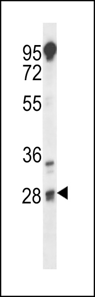 Western blot analysis of TSPY Antibody (C-term) (Cat# 102-12703) pre-incubated without(lane 1) and with(lane 2) blocking peptide in LNCAP cell line lysate. TSPY Antibody (C-term) (arrow) was detected using the purified Pab.