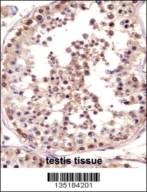 TSPY Antibody (C-term) (102-12703)immunohistochemistry analysis in formalin fixed and paraffin embedded human testis tissue followed by peroxidase conjugation of the secondary antibody and DAB staining.This data demonstrates the use of TSPY Antibody (C-term) for immunohistochemistry. Clinical relevance has not been evaluated.