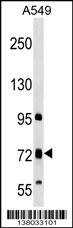 TMC4 Antibody (N-term) (Cat# 102-13566) western blot analysis in A549 cell line lysates (35ug/lane).This demonstrates the TMC4 antibody detected the TMC4 protein (arrow).