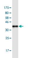 See description below for image caption