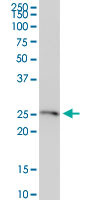 See description below for image caption