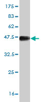 See description below for image caption