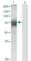 See description below for image caption