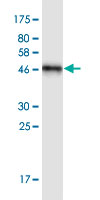 See description below for image caption