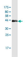 See description below for image caption