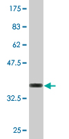 See description below for image caption