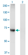 See description below for image caption