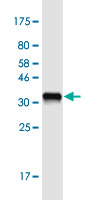 See description below for image caption