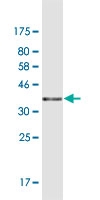 See description below for image caption