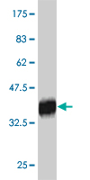 See description below for image caption