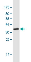 See description below for image caption