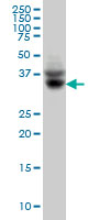 See description below for image caption