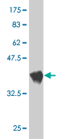 See description below for image caption