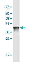 See description below for image caption