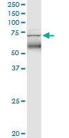 See description below for image caption