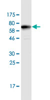 See description below for image caption