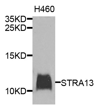 Western blot analysis of extracts of H460 cells, using STRA13 antibody.