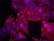 MDA-MB-231 cells were stained with anti-CD44 (clone BJ18), followed by Alexa Fluor® 546 secondary antibody and DAPI (nuclei). Images were aquired on a Nikon FC300 inverted microscope at 20X magnification. Data provided by Dr. John Nolan, La Jolla Bioengineering Institute.