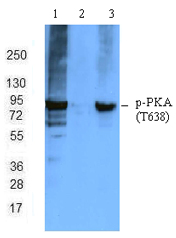 Jurkat total cell lysates were resloved by electrophoresis, transferred to nitrocellulose and probed either with anti-phosphor-PKA (T638) antibody solely (Lane 1), anti-phosphor-PKA (T638) antibody plus phosphor-peptide (Lane 2), or with the anti-phosphor-PKA (T638) antibody plus non-phosphor-peptide (Lane 3). Proteins were visualized using an HRP donkey anti-rabbit secondary antibody and a chemiluminescence detection system.
