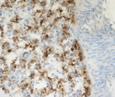 Staining of ABCA3 (3C9) at 10ug/ml on frozen rat lung tissue.