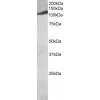 Western blot analysis of PIK3CG in human heart lysate (RIPA buffer, 30 μg total protein per lane) using PIK3CG Antibody at 2 μg/mL.