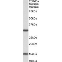 Western blot analysis of Sirt3 in mouse heart lysate (35 μg protein in RIPA buffer) using Sirt3 Antibody at 0.3 μg/mL.