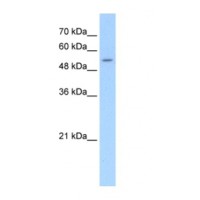 Western blot analysis of SLC26A8 in Jurkat Cell Lysate using SLC26A8 antibody at 5 μg/mL (12% gel).