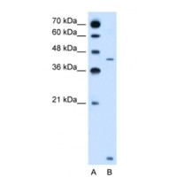 Western blot analysis of SLC46A3 in Jurkat Cell Lysate using SLC46A3 antibody at 2.5 μg/mL (12% gel). Marker in lane A.