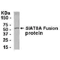 E coli-derived fusion protein as test antigen. Affinity-purified IgY dilution: 1:2000, Goat anti-IgY-HRP dilution: 1:1000. Colorimetric method for signal development.