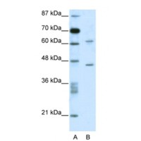 Western blot analysis of C1orf25 in Jurkat Cell Lysate using C1orf25 antibody at 1 μg/mL (12% gel). Marker in lane A.