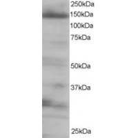 Western Blot staining (0.25μg/ml) of 293 lysate (RIPA buffer, 35μg total protein per lane). Primary incubated for 1 hour. Detected by western blot using chemiluminescence.