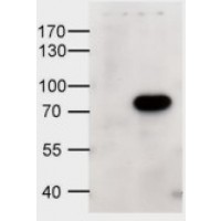 HEK293 overexpressing human ABCD1 and probed with antibody at 1ug/ml (mock transfection in first lane).