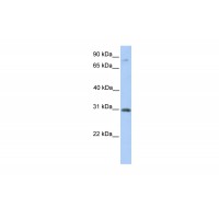 Antibody used in WB on Human Placenta at 0.2-1 ug/ml.