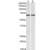 Western Blot (0.3μg/ml) staining of Human Brain (CerWestern Blot ) lysate (35μg protein in RIPA buffer). Primary incubation was 1 hour. Detected by chemiluminescence.