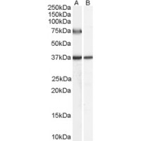 Western Blot (0.5μg/ml) staining of Human Liver lysate (35μg protein in RIPA buffer) with (B) and without (A) blocking with the immunising peptide. Primary incubation was 1 hour. Detected by chemiluminescence.