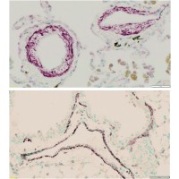 Immunohistochemistry (2.5 μg/ml) staining of paraffin embedded Human Lung (top) and Mouse Lung (bottom). Trypsin-mediated antigen retrieval, HRP-staining. Bar in right lower corner represents 50um.