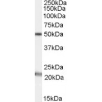 Western Blot (1μg/ml) staining of Human Brain (Substantia nigra) lysate (35μg protein in RIPA buffer). Primary incubation was 1 hour. Detected by chemiluminescence.