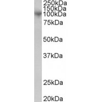 Western Blot (1μg/ml) staining of Human Bone Marrow lysate (35μg protein in RIPA buffer). Primary incubation was 1 hour. Detected by chemiluminescence.