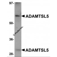 Western blot analysis of ADAMTSL5 in human skeletal muscle tissue lysate with ADAMTSL5 antibody at 1 μg/mL.