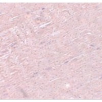 Immunohistochemistry of ADAMTSL5 in mouse skeletal muscle tissue with ADAMTSL5 antibody at 5 μg/mL.