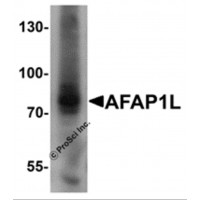 Western blot analysis of AFAP1L1 in A549 cell lysate with AFAP1L1 antibody at 1 μg/mL.