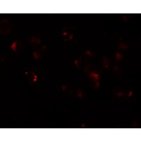Immunofluorescence of AFAP1L in A549 cells with AFAP1L antibody at 20 μg/mL.