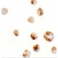Immunocytochemistry of AFAP1L in A549 cells with AFAP1L antibody at 5 μg/mL.