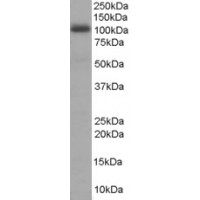 Western Blot staining (1μg/ml) of Human Liver lysate (RIPA buffer, 35μg total protein per lane). Primary incubated for 1 hour. Detected by western blot using chemiluminescence.