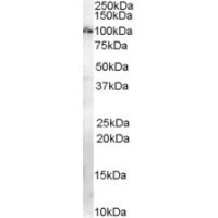 Western Blot (1μg/ml) staining of Mouse Brain lysate (35μg protein in RIPA buffer). Primary incubation was 1 hour. Detected by chemiluminescence.