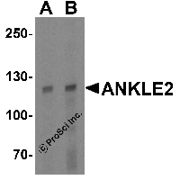 Western blot analysis of ANKLE2 in human testis tissue lysate with ANKLE2 antibody at (A) 1 and (B) 2 μg/mL.