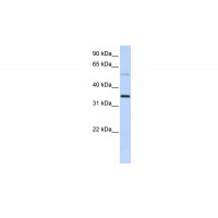 Antibody used in WB on Transfected 293T at 0.2-1 ug/ml.