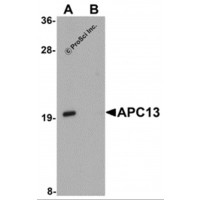 Western blot analysis of APC13 in Jurkat cell tissue lysate with APC13 antibody at 1 μg/mL in (A) the absence and (B) the presence of blocking peptide.